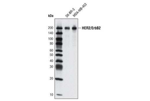 Western Blotting Image 1: HER2/ErbB2 (M45) Antibody