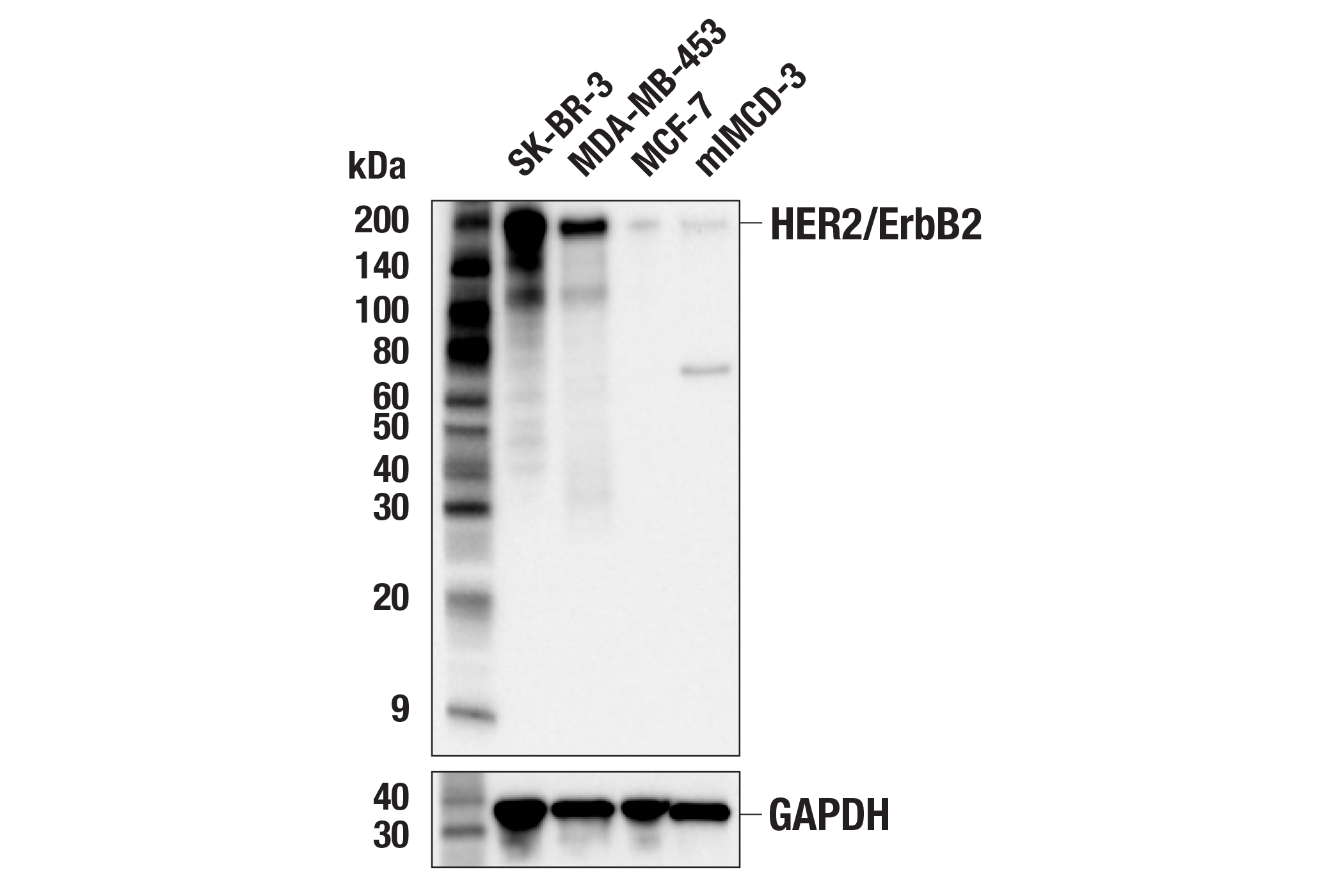 Western Blotting Image 1: HER2/ErbB2 (M45) Antibody