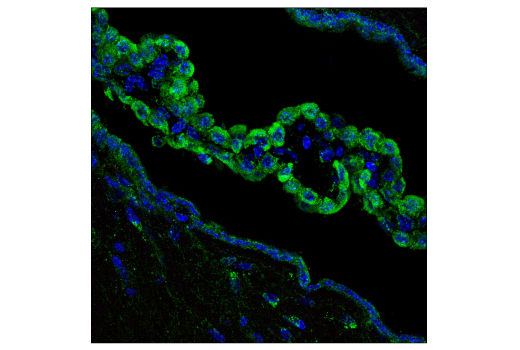 Immunofluorescence Image 1: FIS1 (E3K9O) Rabbit mAb