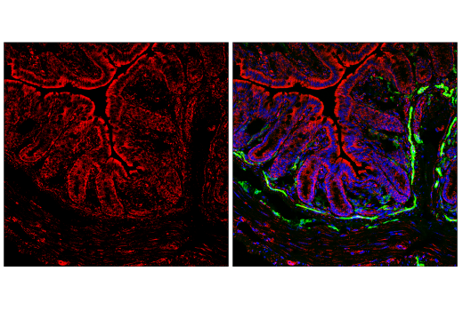 Immunofluorescence Image 2: FIS1 (E3K9O) Rabbit mAb