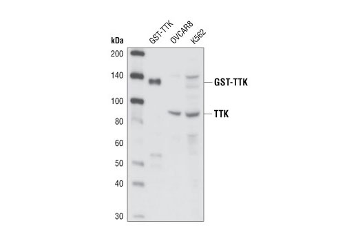 Western Blotting Image 1: TTK Antibody