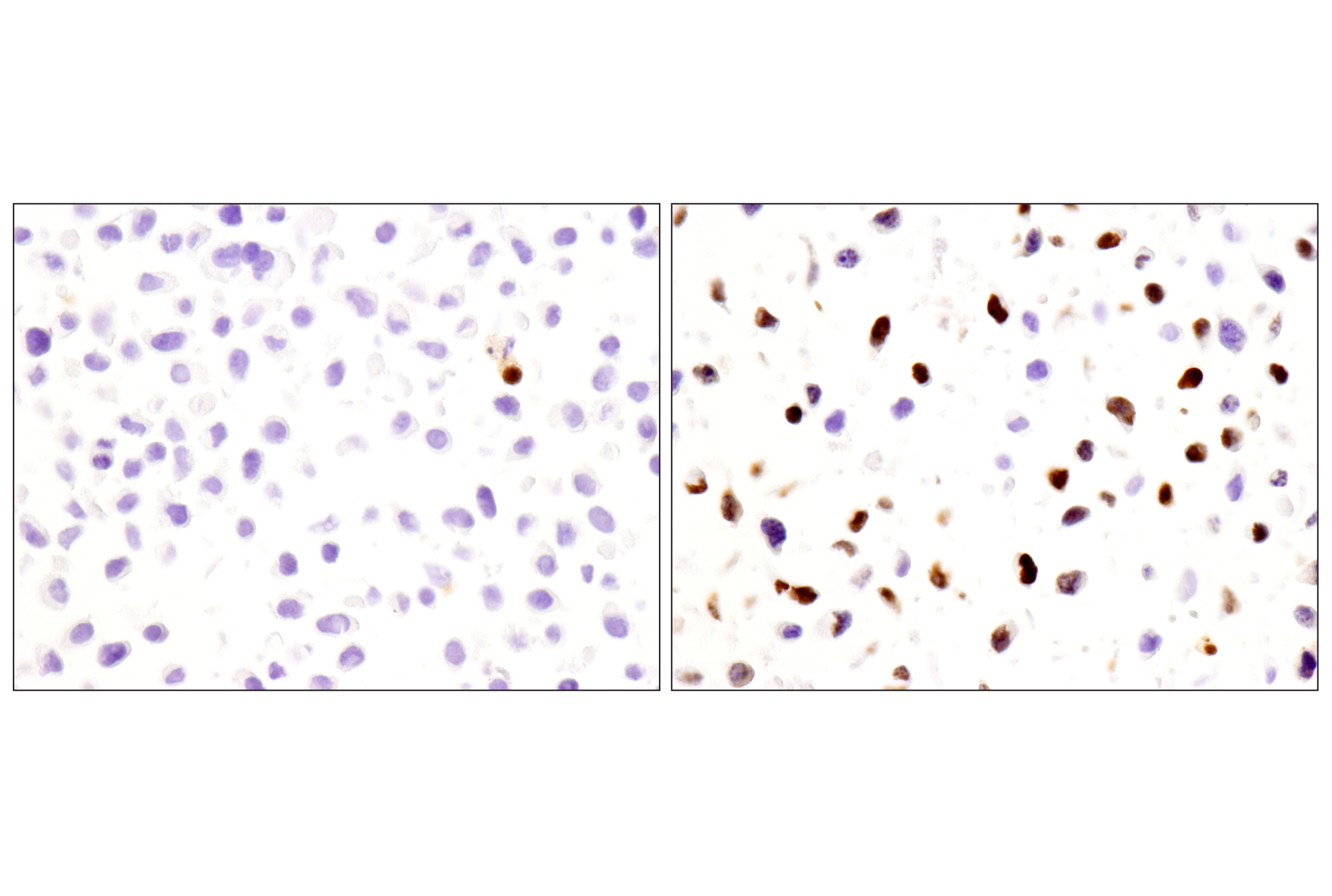 Immunohistochemistry Image 1: Cleaved-PARP (Asp214) (E2T4K) Mouse mAb