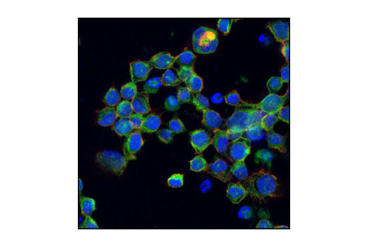 Immunofluorescence Image 1: IRF-5 Antibody