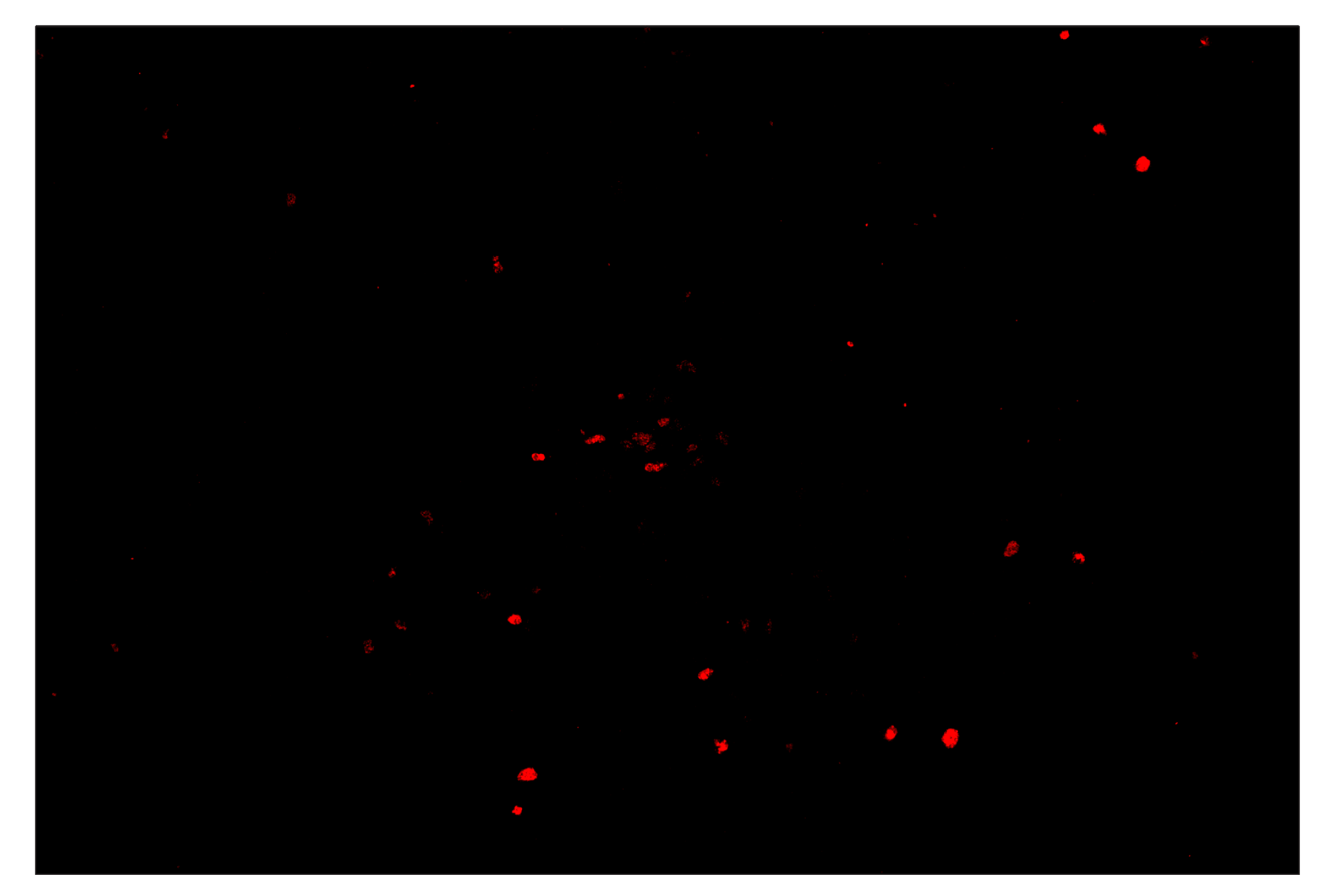 Immunohistochemistry Image 4: Phospho-Histone H2A.X (Ser139) (D7T2V) & CO-0135-750 SignalStar™ Oligo-Antibody Pair