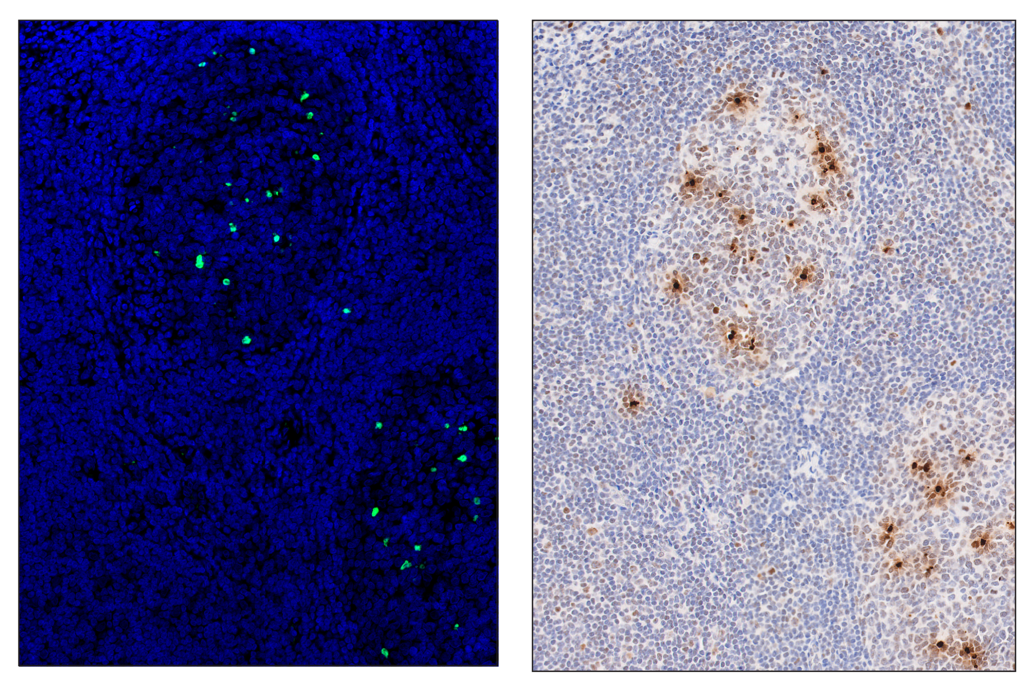 Immunohistochemistry Image 6: Phospho-Histone H2A.X (Ser139) (D7T2V) & CO-0135-750 SignalStar™ Oligo-Antibody Pair