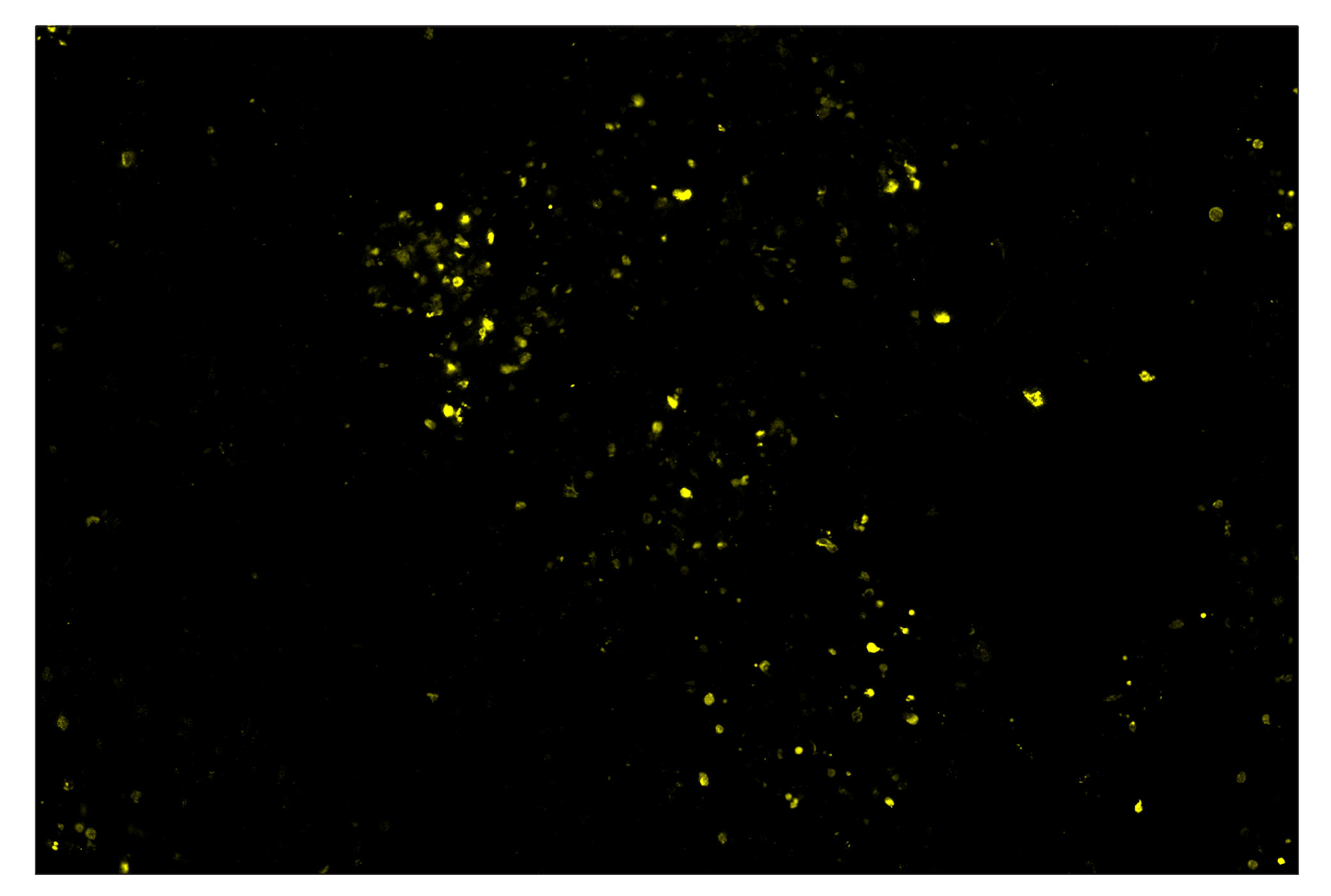 Immunohistochemistry Image 3: Phospho-Histone H2A.X (Ser139) (D7T2V) & CO-0135-750 SignalStar™ Oligo-Antibody Pair