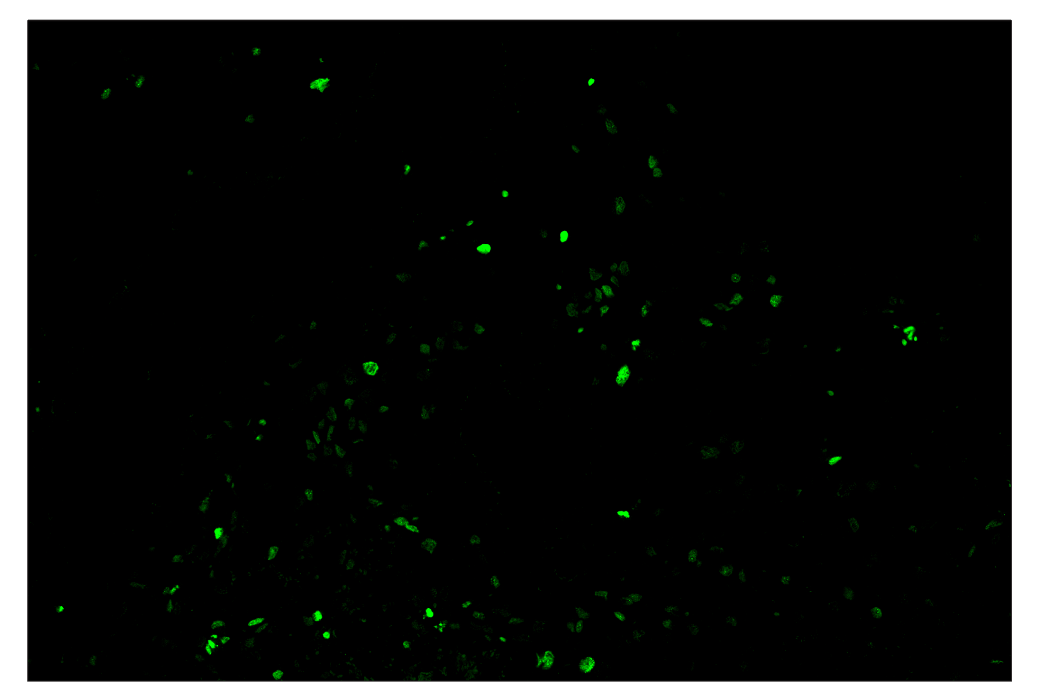Immunohistochemistry Image 2: Phospho-Histone H2A.X (Ser139) (D7T2V) & CO-0135-750 SignalStar™ Oligo-Antibody Pair
