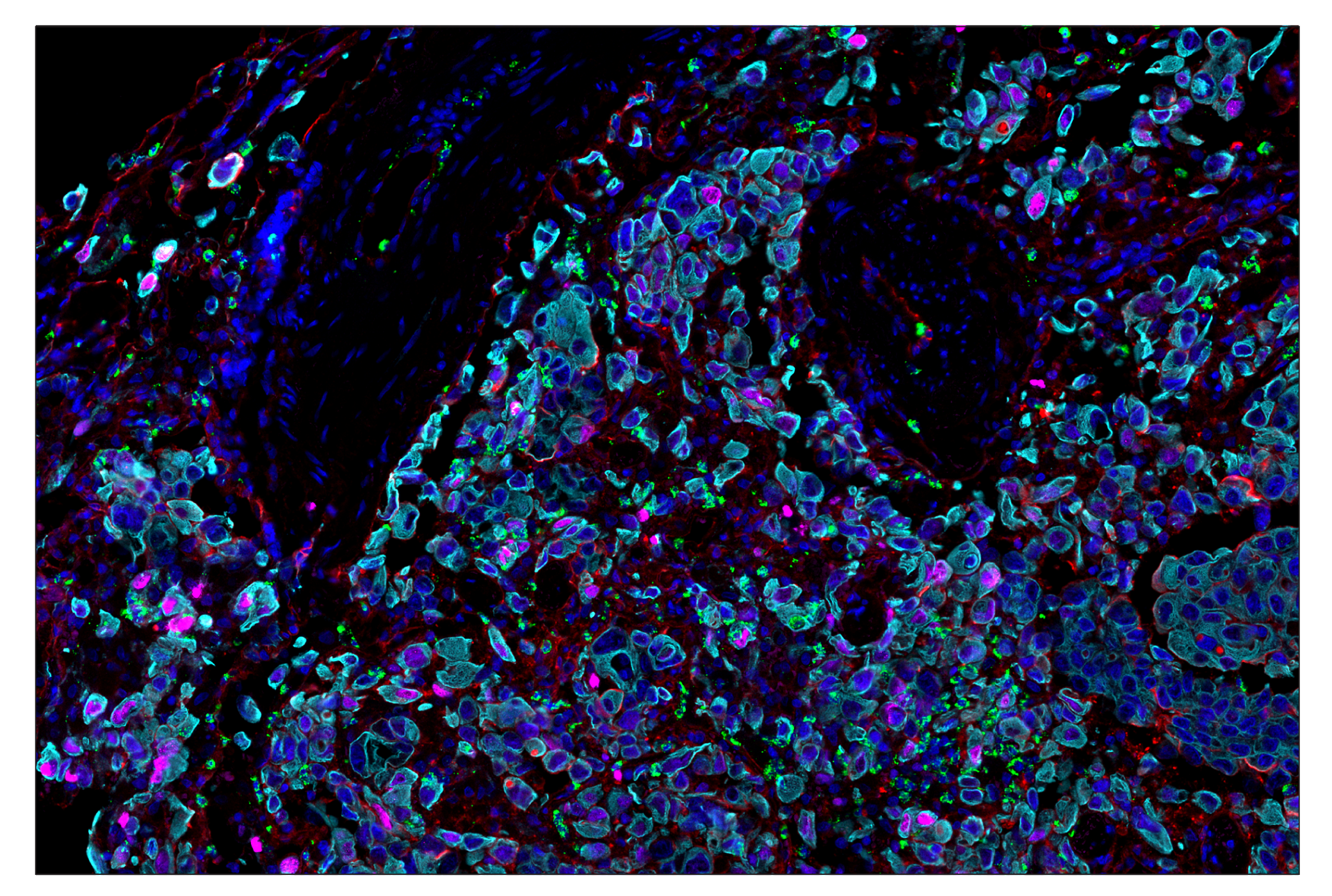 Immunohistochemistry Image 7: Phospho-Histone H2A.X (Ser139) (D7T2V) & CO-0135-750 SignalStar™ Oligo-Antibody Pair
