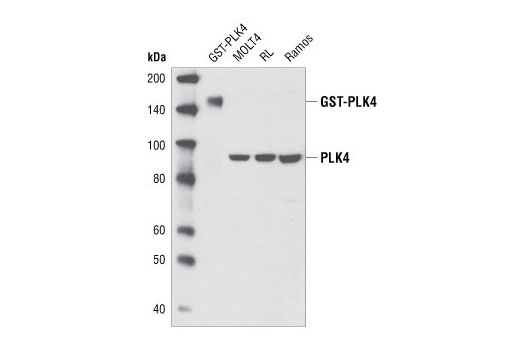 Western Blotting Image 1: PLK4 Antibody
