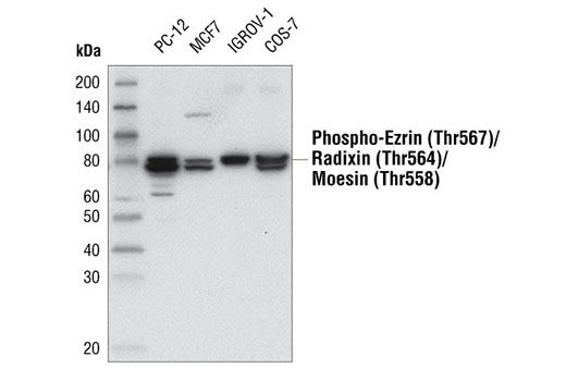 Western Blotting Image 1: Phospho-Ezrin (Thr567)/Radixin (Thr564)/Moesin (Thr558) (48G2) Rabbit mAb (BSA and Azide Free)