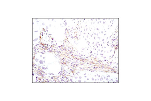 Immunohistochemistry Image 4: PDGF Receptor α (D1E1E) XP® Rabbit mAb (BSA and Azide Free)