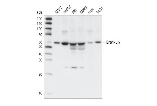 Western Blotting Image 1: Ero1-Lα Antibody