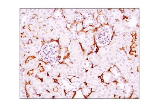 Immunohistochemistry Image 1: VCAM-1 (D2T4N) Rabbit mAb