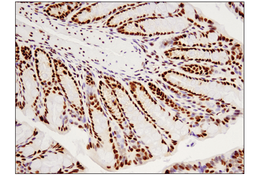Immunohistochemistry Image 1: TDP43 (D9R3L) Rabbit mAb (BSA and Azide Free)