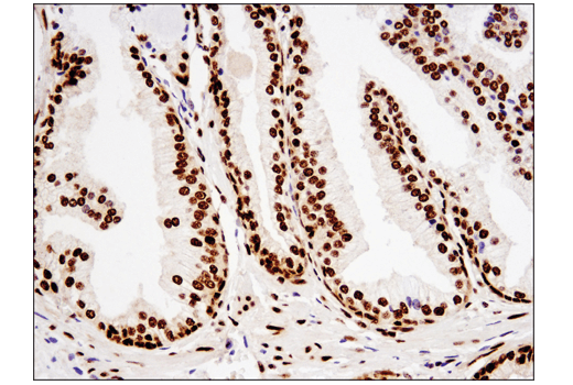 Immunohistochemistry Image 2: TDP43 (D9R3L) Rabbit mAb (BSA and Azide Free)