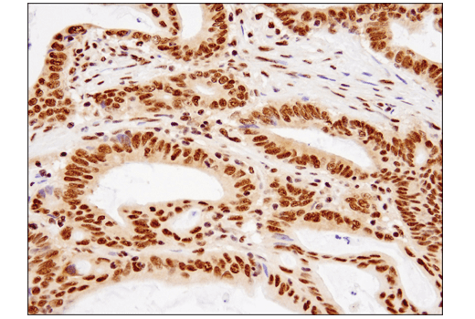 Immunohistochemistry Image 3: TDP43 (D9R3L) Rabbit mAb (BSA and Azide Free)