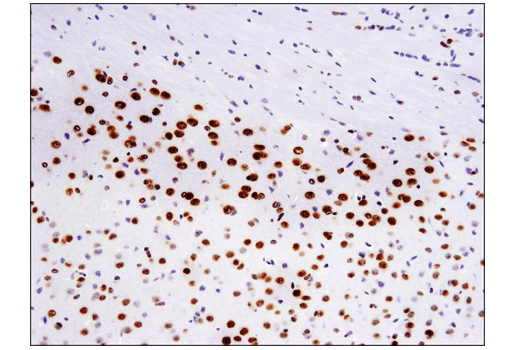 Immunohistochemistry Image 4: TDP43 (D9R3L) Rabbit mAb (BSA and Azide Free)