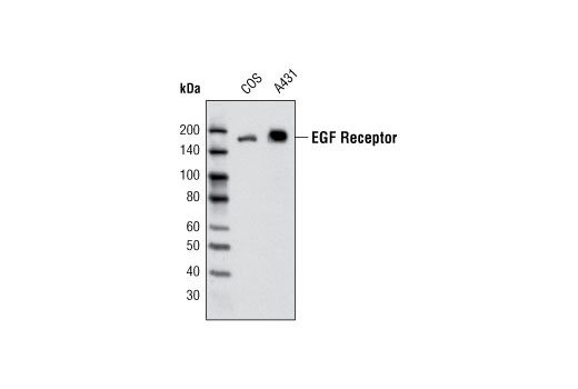 Western Blotting Image 1: EGF Receptor (V279) Antibody