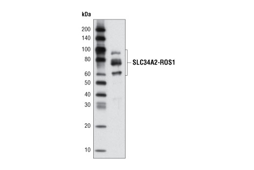 Western Blotting Image 1: ROS1 (69D6) Mouse mAb