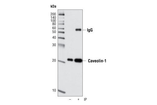 Immunoprecipitation Image 1: Caveolin-1 (D46G3) XP® Rabbit mAb
