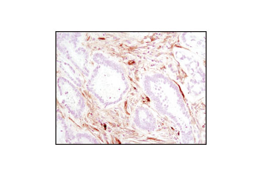 Immunohistochemistry Image 1: Caveolin-1 (D46G3) XP® Rabbit mAb