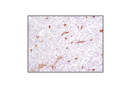 Immunohistochemistry Image 2: Caveolin-1 (D46G3) XP® Rabbit mAb