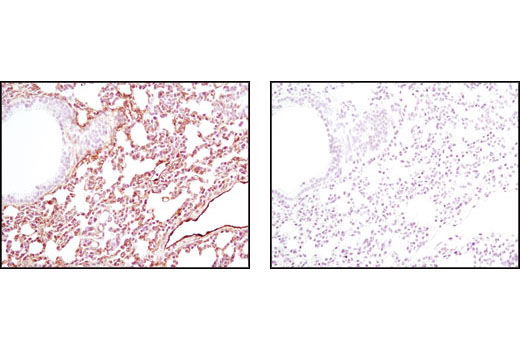 Immunohistochemistry Image 3: Caveolin-1 (D46G3) XP® Rabbit mAb