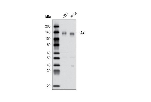 Western Blotting Image 1: Axl (L283) Antibody