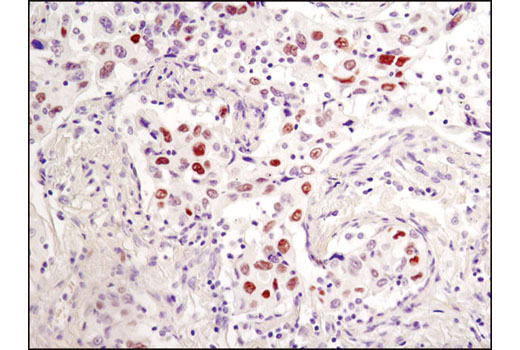 Immunohistochemistry Image 3: Phospho-c-Jun (Ser73) (D47G9) XP® Rabbit mAb