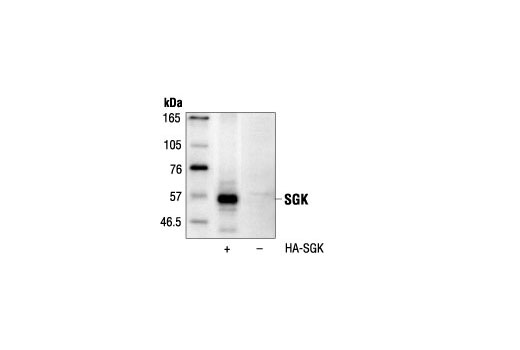 Western Blotting Image 1: SGK Antibody