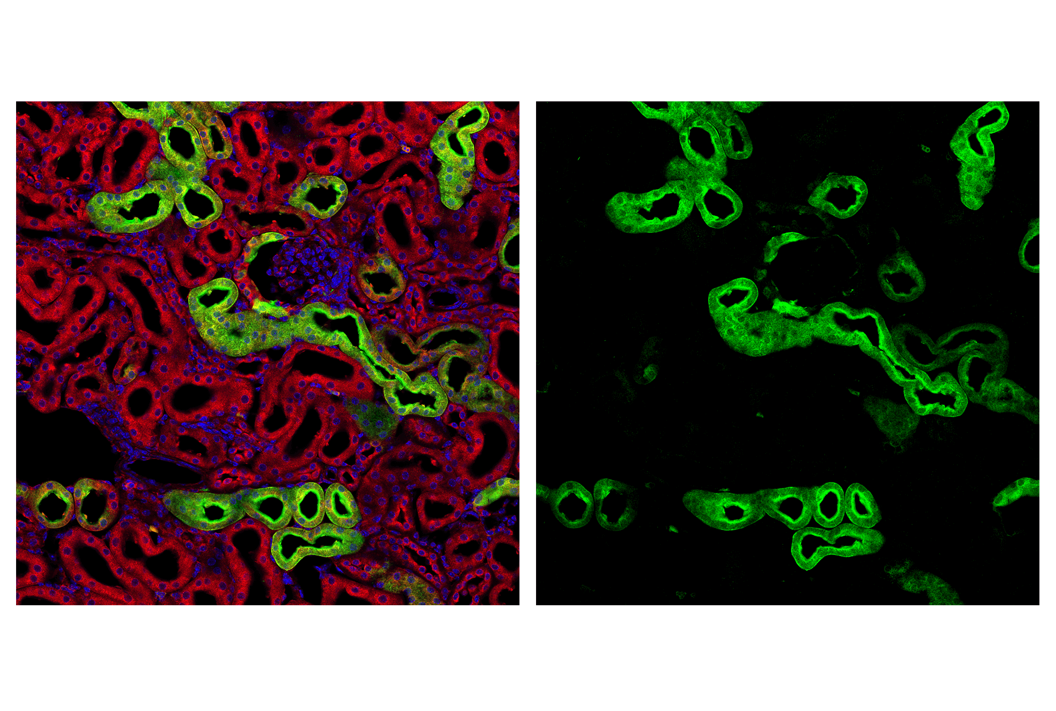 Immunofluorescence Image 1: PHGDH (D3D5E) Rabbit mAb (IF Formulated)