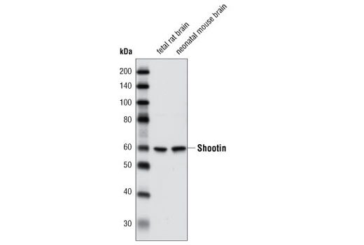 Western Blotting Image 1: Shootin1 Antibody