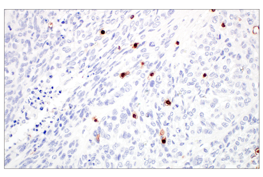 Immunohistochemistry Image 9: CD7 (E4G1Q) XP® Rabbit mAb