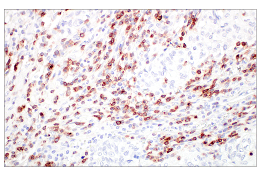 Immunohistochemistry Image 7: CD7 (E4G1Q) XP® Rabbit mAb