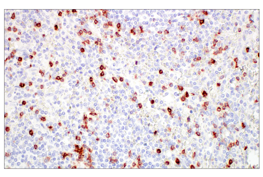 Immunohistochemistry Image 5: CD7 (E4G1Q) XP® Rabbit mAb