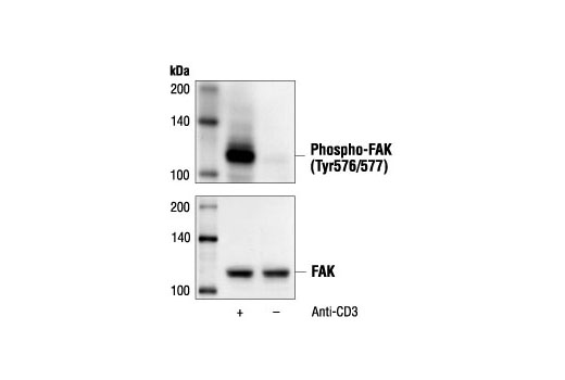 Western Blotting Image 1: Phospho-FAK (Tyr576/577) Antibody