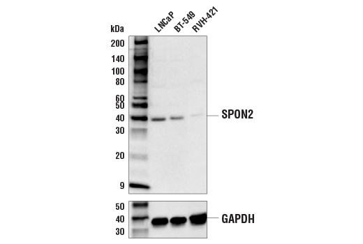 Western Blotting Image 1: SPON2 Antibody