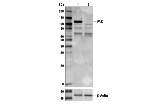  Image 4: Focal Adhesion Protein Antibody Sampler Kit