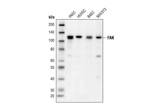  Image 9: Focal Adhesion Protein Antibody Sampler Kit