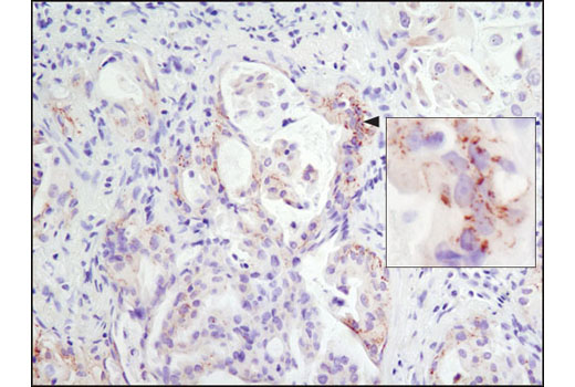 Immunohistochemistry Image 1: ROS1 (D4D6®) Rabbit mAb