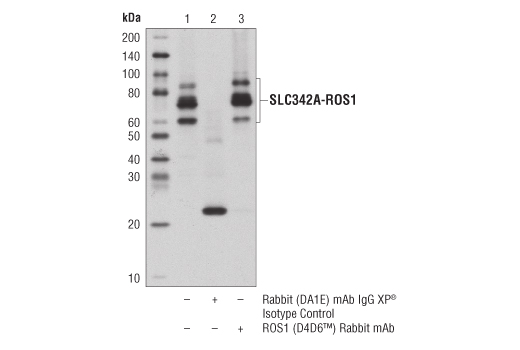 Immunoprecipitation Image 1: ROS1 (D4D6®) Rabbit mAb