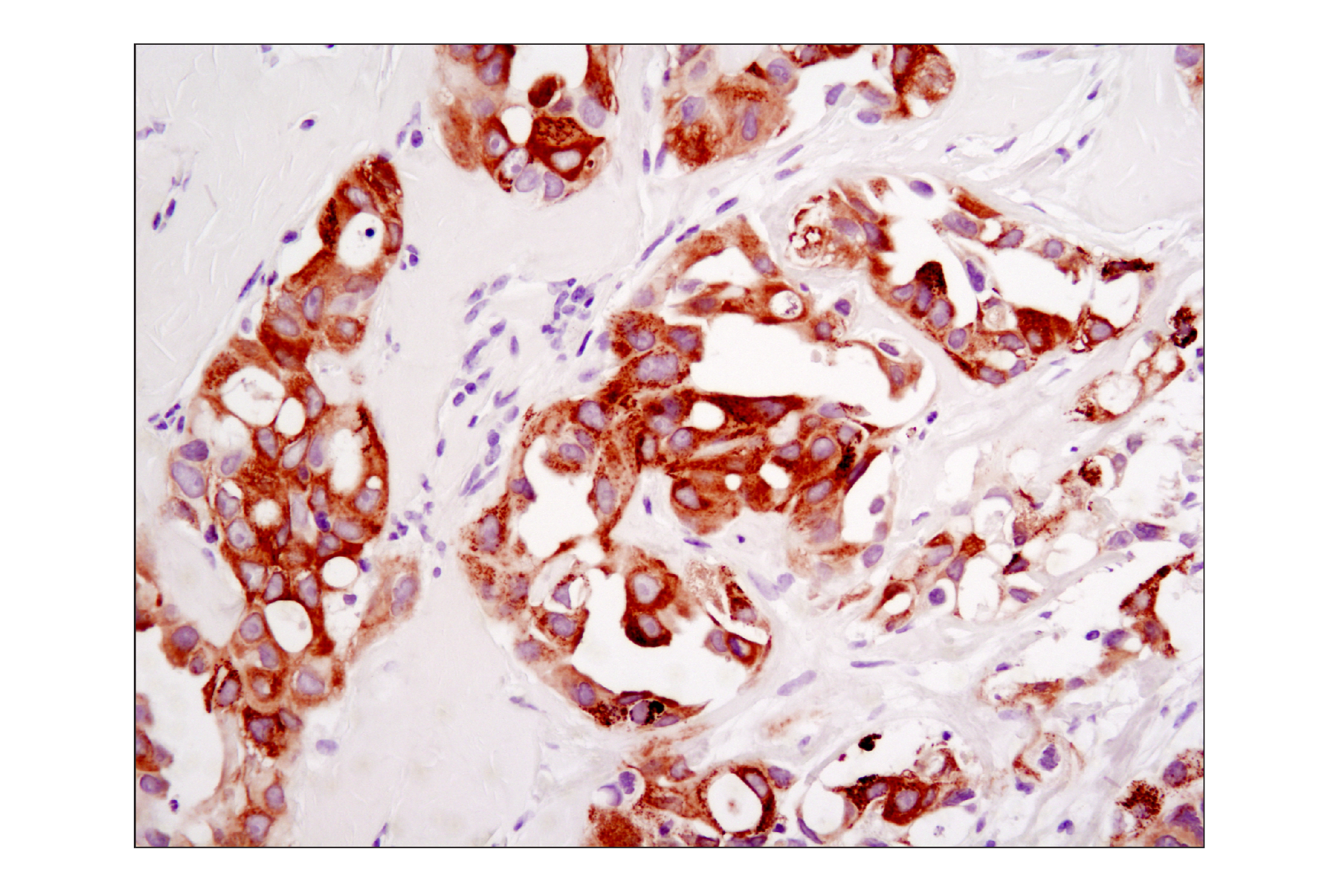  Image 55: Lung Cancer RTK Antibody Sampler Kit