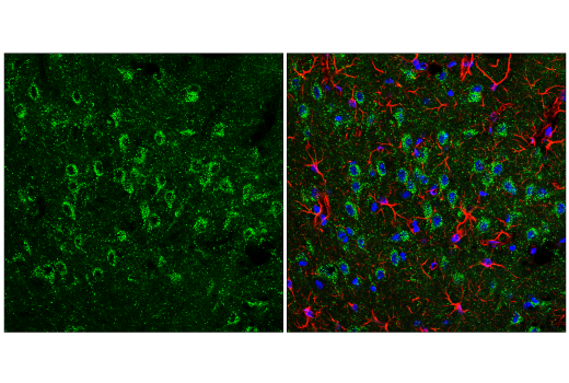 Immunofluorescence Image 2: EEA1 (C45B10) Rabbit mAb