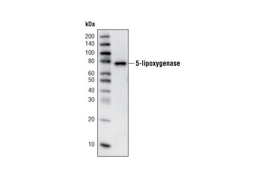 Western Blotting Image 1: 5-Lipoxygenase (C49G1) Rabbit mAb