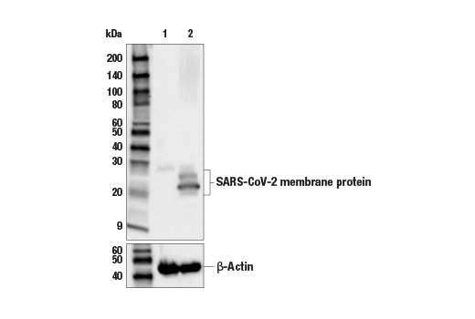 Western Blotting Image 1: SARS-CoV-2 Membrane Protein (E3V5H) Mouse mAb