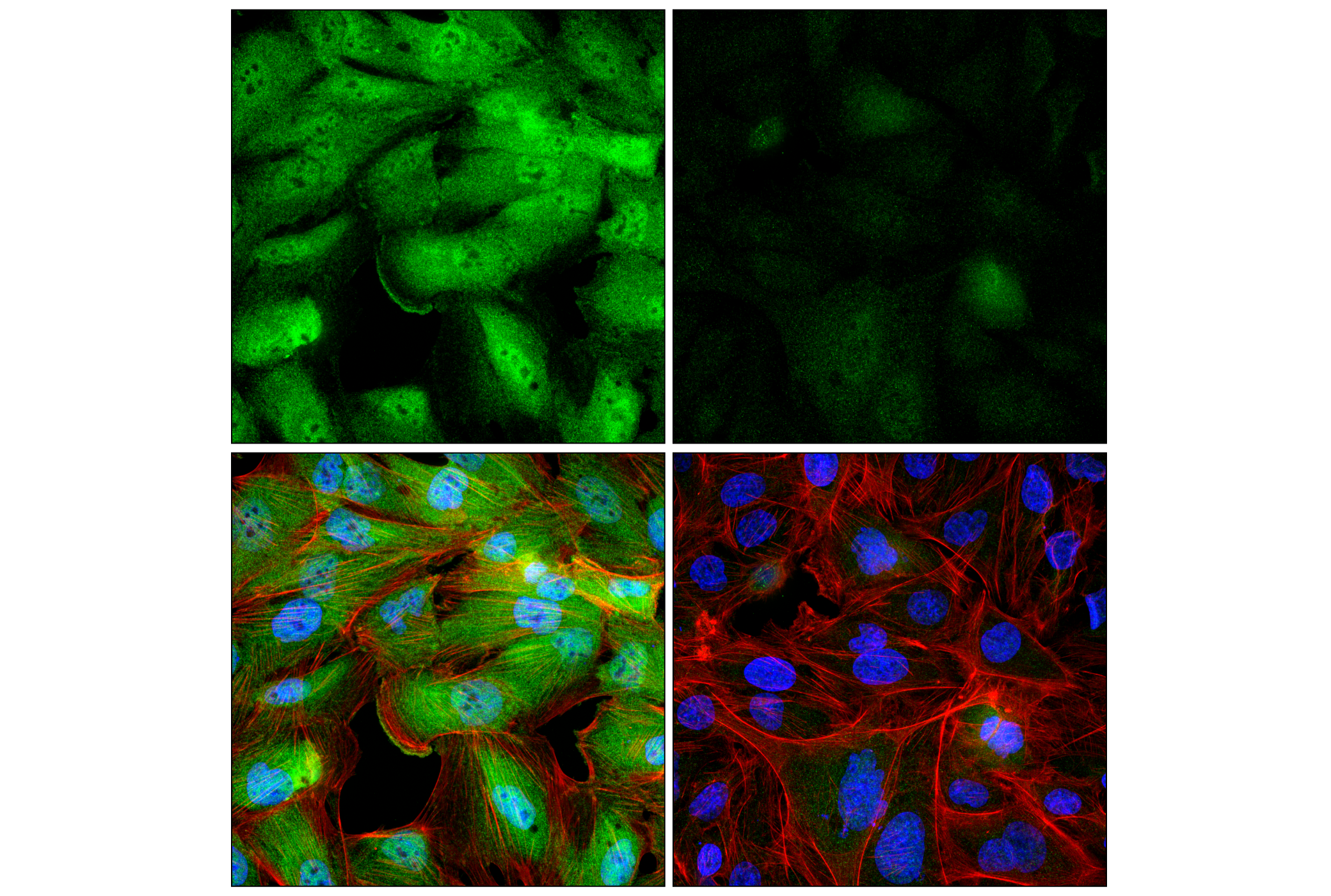 Immunofluorescence Image 1: UBE3C (F2S2J) Rabbit Monoclonal Antibody