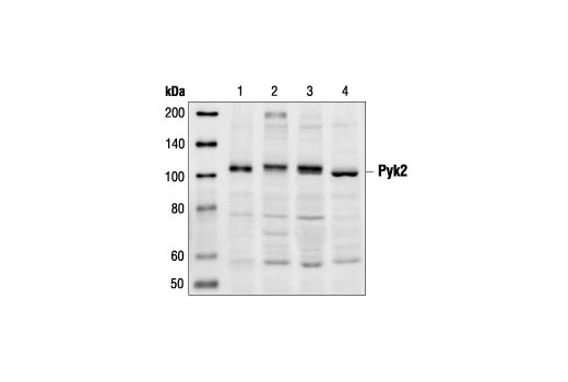 Western Blotting Image 1: Pyk2 Antibody
