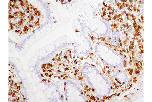 Immunohistochemistry Image 1: Annexin A1 (D5V2T) XP® Rabbit mAb (BSA and Azide Free)