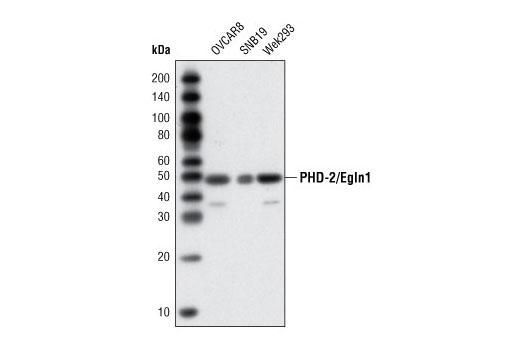 Western Blotting Image 1: PHD-2/Egln1 Antibody