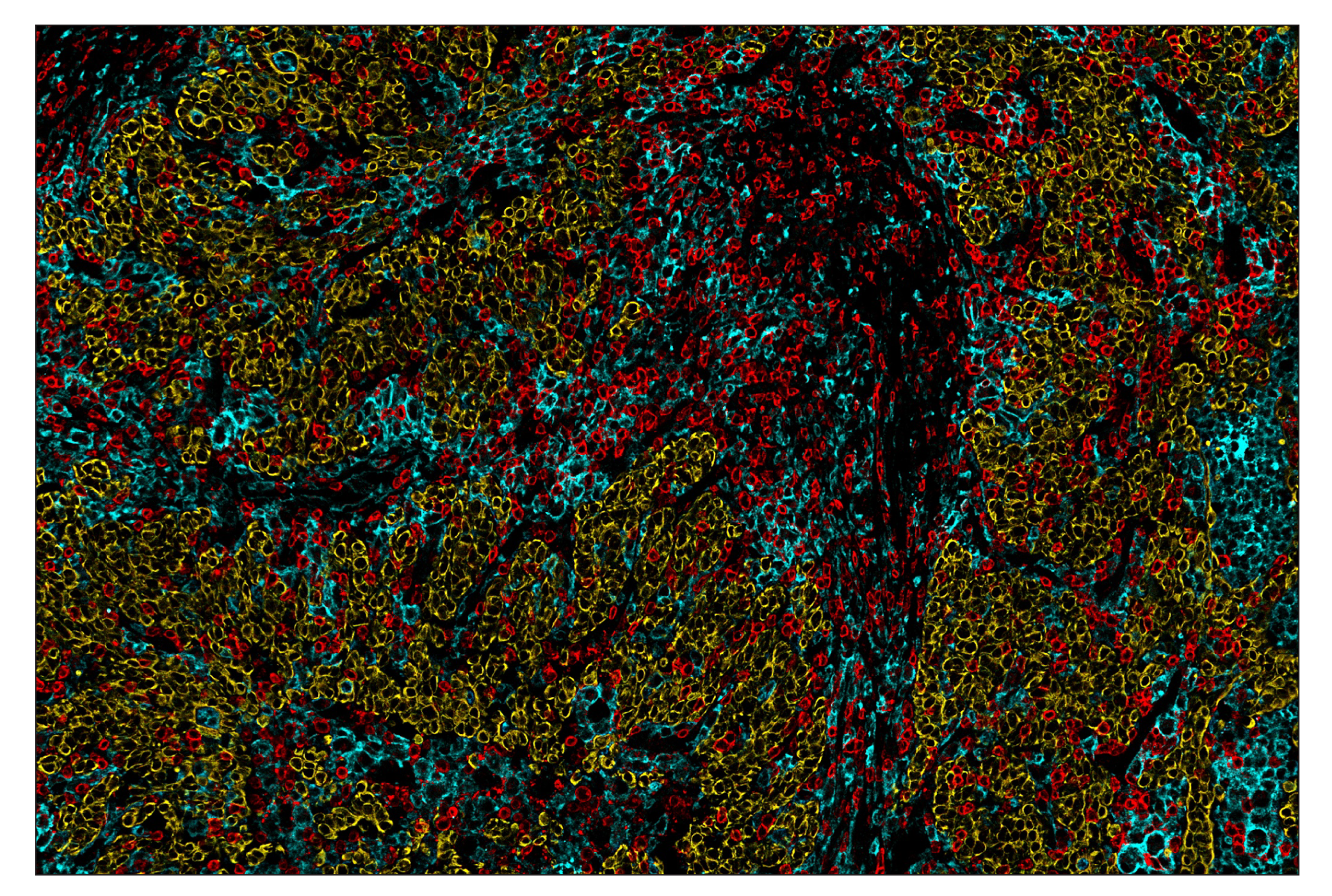 Immunohistochemistry Image 7: Pan-Keratin (C11) & CO-0003-647 SignalStar™ Oligo-Antibody Pair